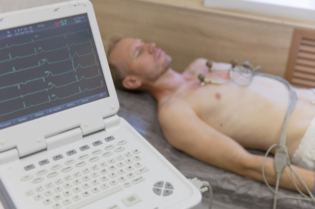 Electrocardiograma Electrocardiograma